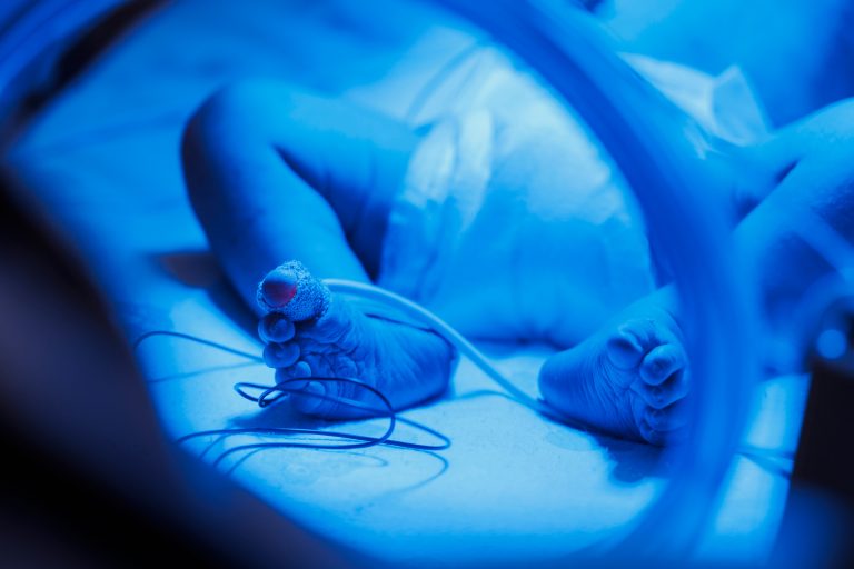 Baby in neonatal ward